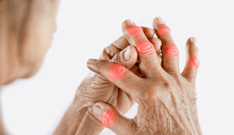 Rheumatology